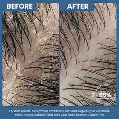 Luvvel Anti Dandruff Shampoo - Pomegranate & Reetha Extracts